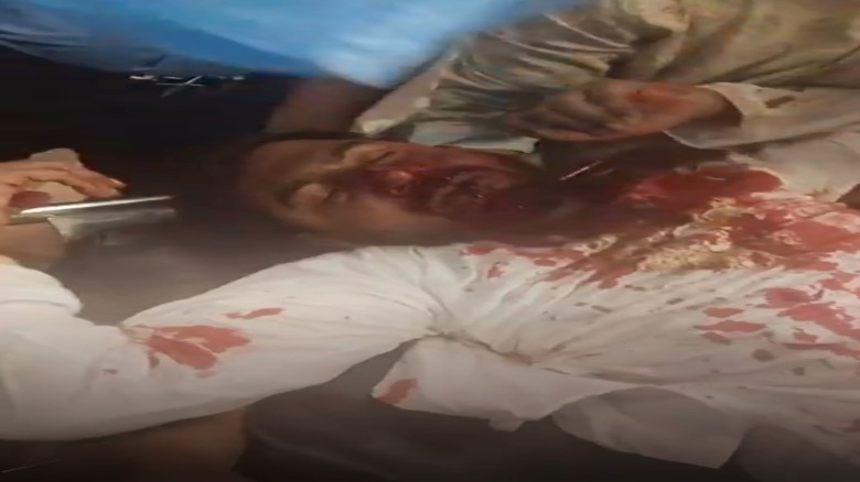 রক্তাক্ত সংঘর্ষে নুর — ঢাকা রাজনীতিতে নতুন অস্থিরত...