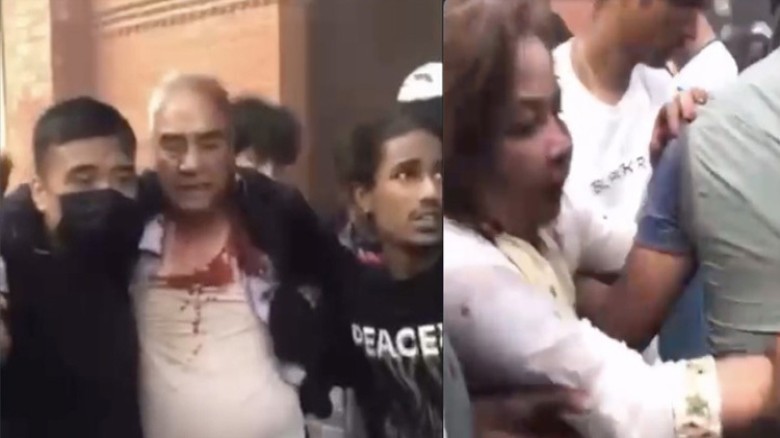 হামলায় আহত দেউবা দম্পতি/ ছবি: অন্নপূর্ণা এক্সপ্রেস